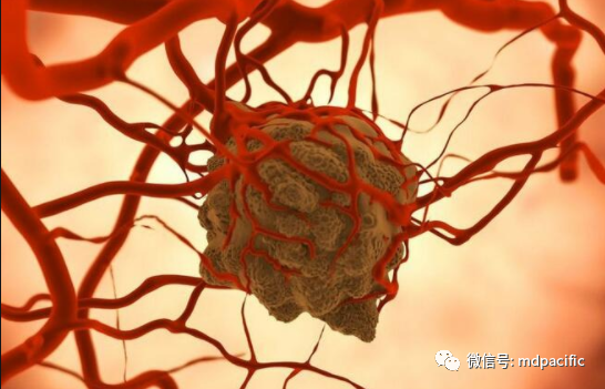 惡性腫瘤與血栓的關(guān)系
